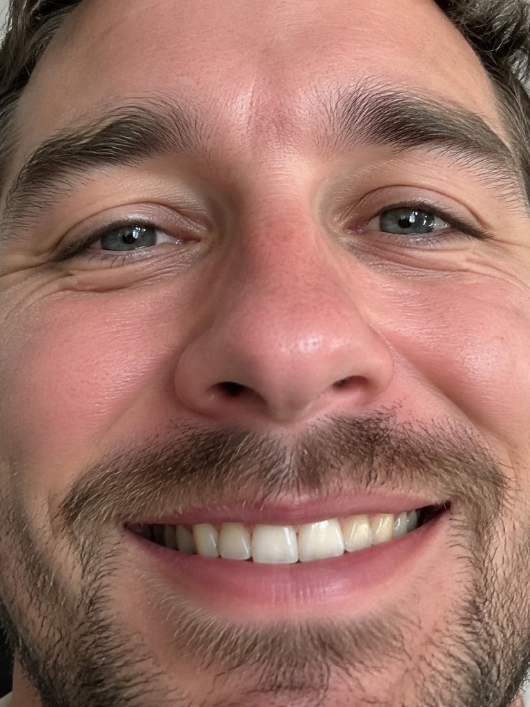 Face filling the whole frame, no shoulders or hands
